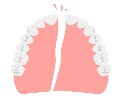 Broken dentures (upper jaw), JPG, PNG and AI Broken dentures (upper jaw), denture, tooth, cracked, JPG, PNG and AI