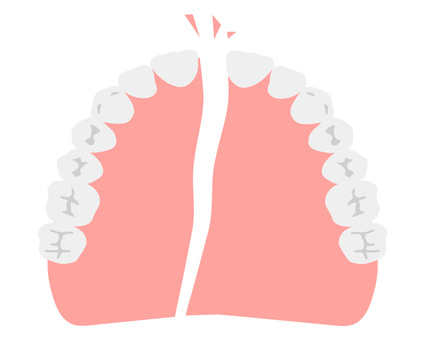 Broken dentures (upper jaw), dentadura, diente, diente artificial, JPG, PNG and AI