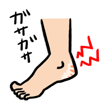 ひび割れしたガサガサなかかと２ かかと,足,ガサガサ,乾燥,ひび割れ,裸足,素足,角質,トラブル,粉吹きのイラスト素材