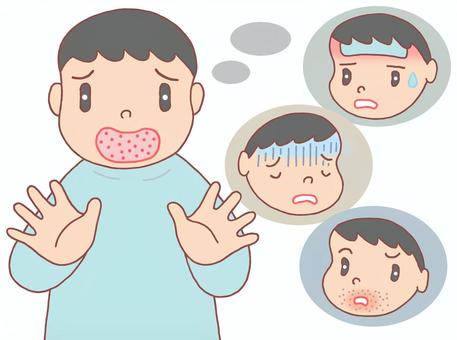 手足口病・ウイルス性感染症 手足口病,口内炎,頭痛,発熱,悪心,発疹,ウイルス性感染症,子供,疾患,男子のイラスト素材