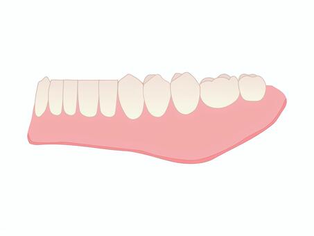 下顎総義歯 斜め45度（主線なし） フルデンチャー,総義歯,入れ歯,下顎義歯,歯科技工,歯科技工士,歯科,医療,教材用イラスト,vectorのイラスト素材