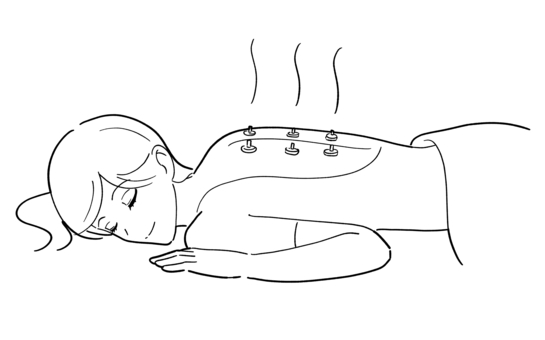 背中にお灸をする女性の白黒イラスト 背中にお灸をする女性の白黒イラスト お灸,鍼灸,東洋医学,ツボ,背中,リラクゼーション,リラックス,画像,白黒,モノクロのイラスト素材