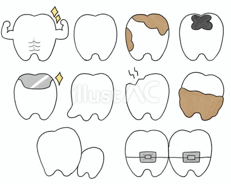いろんな症状の歯のイラストセット 歯,teeth,歯医者のイラスト素材
