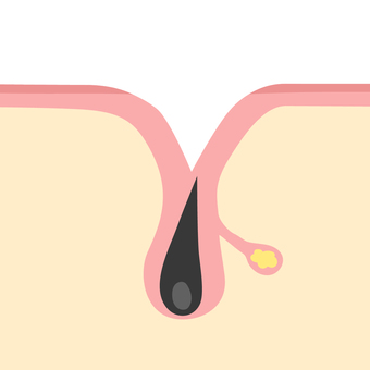 Open pores, JPG, PNG and AI Open pores, pores, open, it's open., JPG, PNG and AI