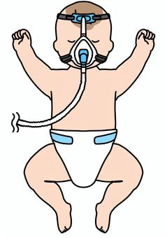 NPPVをつけた赤ちゃん　カラー