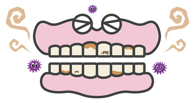 入れ歯のキャラクタ(4) 入れ歯,キャラクター,かわいい,歯科,歯,総入れ歯,義歯,歯垢,歯石,汚いのイラスト素材