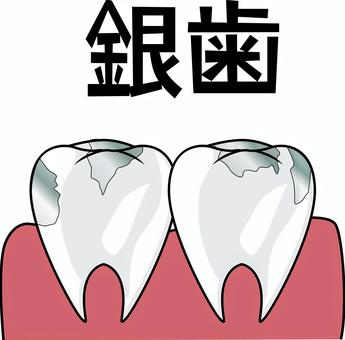 銀歯　　 銀歯,治療,詰め物,口内,歯茎,健康,イメージ,漢字,線画のイラスト素材
