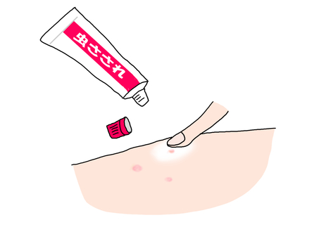 虫刺されの患部に塗り薬を塗る 虫刺され,蚊,かゆみ止め,塗り薬,患部,発疹,塗布,処方のイラスト素材