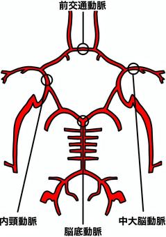 脳動脈瘤のできやすい場所　カラー 脳動脈瘤,血管,名称,脳底動脈,前交通動脈のイラスト素材