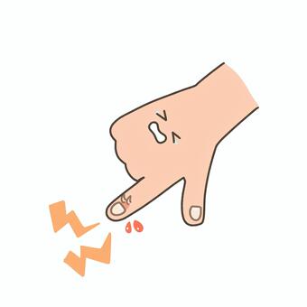 さかむけ さかむけ,指先,爪,皮膚,手,ケア,軽いケガ,乾燥,手荒れ,健康のイラスト素材