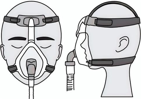 鼻口NPPV装着正面横顔　白黒
