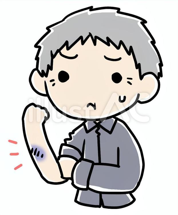 あおあざのあるおじいさん 青あざ,おじいさん,負傷のイラスト素材
