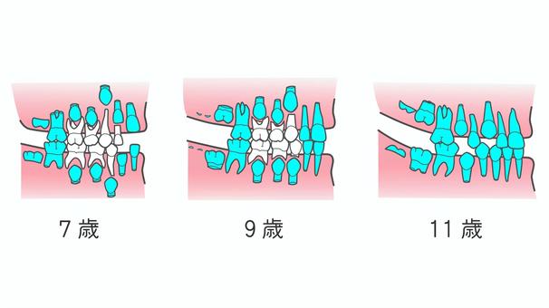 生え変わり_7～11歳 生え変わり,乳歯,永久歯,混合歯列,7歳,9歳,11歳,小学生,歯並び,歯科のイラスト素材