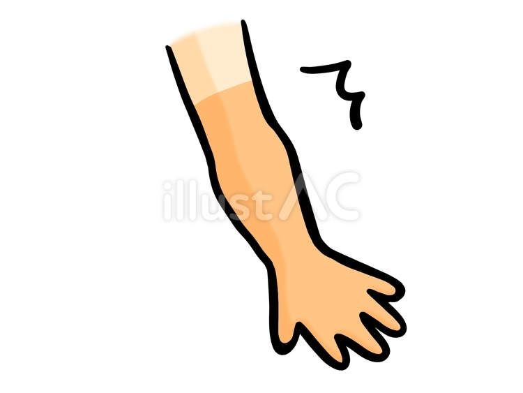 くっきり日焼けあと 日焼け,焼ける,くっきりのイラスト素材