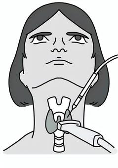 甲状腺にエコーしながら針　女性白黒 甲状腺,エコー,針,女性,白黒のイラスト素材