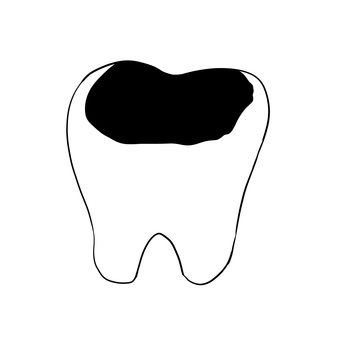 虫歯 虫歯,病気,人体,シンプル,白色のイラスト素材