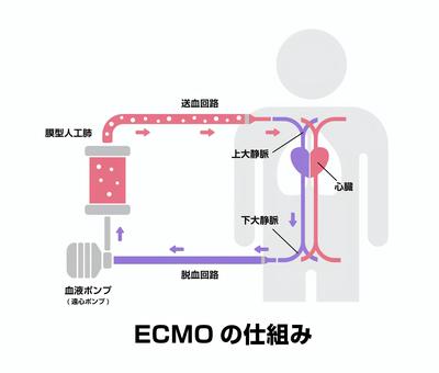 ECMO (エクモ) の構造と仕組み ECMO (エクモ) の構造と仕組み ecmo,エクモ,体外式膜型人工肺,人工肺,治療,救命設備,医療,人工呼吸器,仕組み,構造のイラスト素材