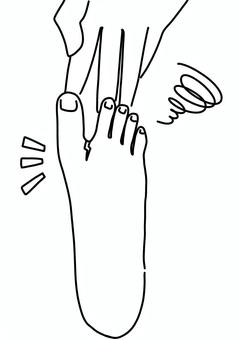 母趾と第二趾の間にひび割れ　線画 母趾,足,指間,トラブル,ひび割れ,線画のイラスト素材