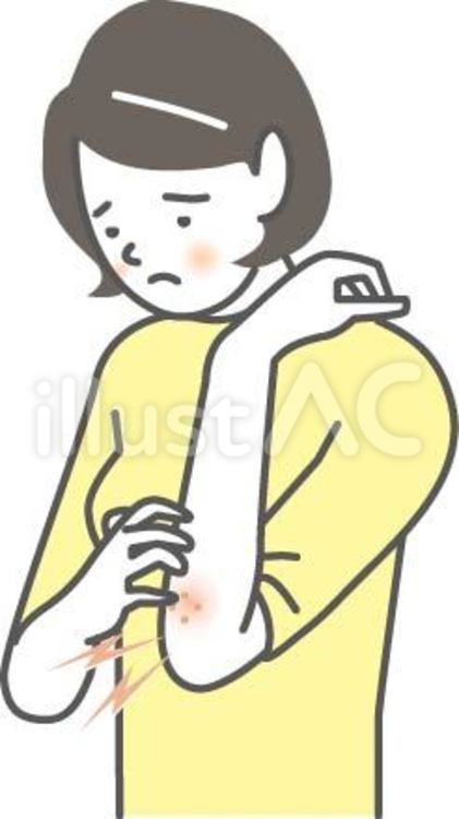 乾燥肌・アトピー腕 痒み,肌荒れ,乾燥肌のイラスト素材