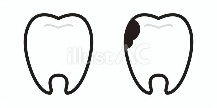 歯のシルエットアイコン 歯,歯科,歯医者のイラスト素材