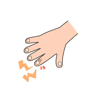 さかむけ さかむけ,指先,爪,皮膚,手,ケア,軽いケガ,乾燥,手荒れ,健康のイラスト素材