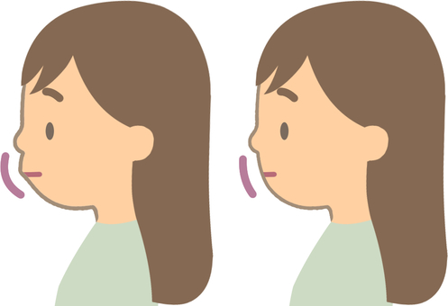口のでっぱりのあるなし1 出っ歯,口,出る,口元,上顎前突,反っ歯,上下顎前突,女性,横顔,比較のイラスト素材