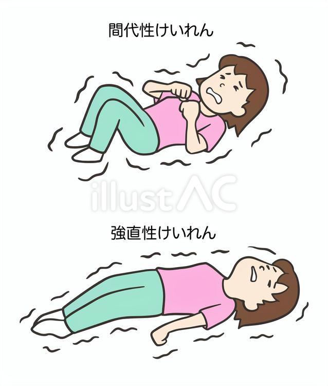 間代性痙攣と強直性痙攣、女性1 間代性痙攣,強直性痙攣,てんかんのイラスト素材