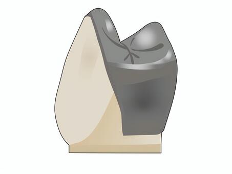 プロキシマルハーフクラウン（主線あり） 歯科,クラウン,補綴,小臼歯,歯科技工,医療,教材用イラスト,vectorのイラスト素材