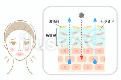 乾燥肌 断面図 女性