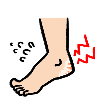 ひび割れしたガサガサなかかと１ かかと,足,ガサガサ,乾燥,ひび割れ,裸足,素足,角質,トラブル,粉吹きのイラスト素材