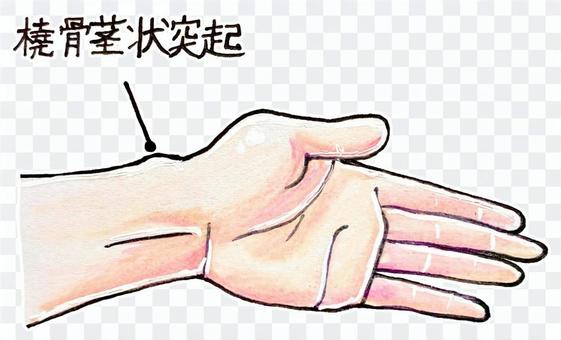 Styloid protrusion of radius Styloid protrusion of radius