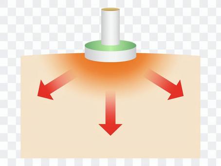 Work of moxibustion Work of moxibustion