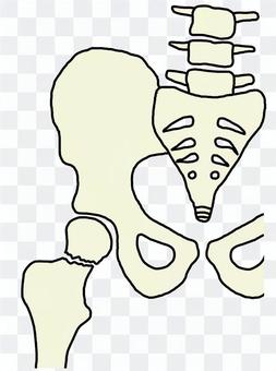 Fracture of thigh neck 820x110 Fracture of thigh neck 820x110