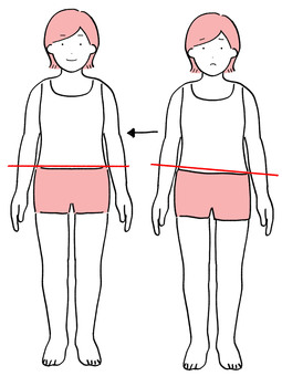 After pelvic distortion and improvement After pelvic distortion and improvement