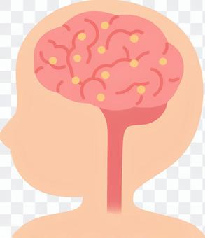 Brain (Lewy body dementias) Brain (Lewy body dementias)