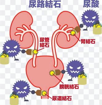 Medical-Uric Acid 06 Medical-Uric Acid 06