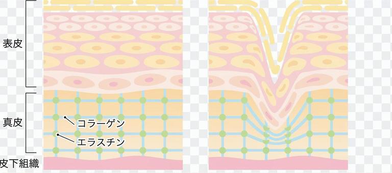 Skin wrinkle section Skin wrinkle section