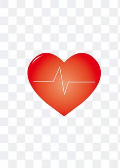 electro-cardiogram electro-cardiogram