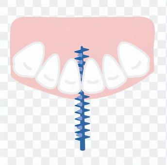 Interdental brush Interdental brush
