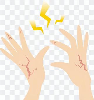 Hands / rough skin Hands / rough skin