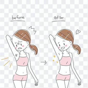 Hair removal before and after Hair removal before and after