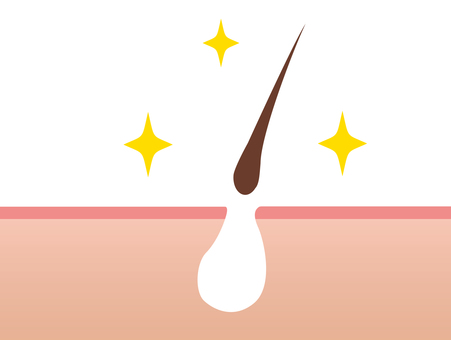 Hair loss Hair loss